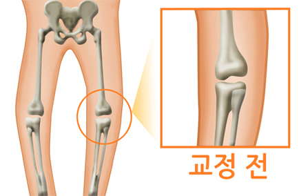 교정전