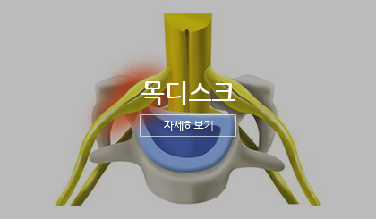 목디스크 자세히보기