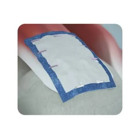 리제네텐 패치를 힘줄 위에 덮고 가장자리를 작은 고정물로 눌러 붙인 모습.