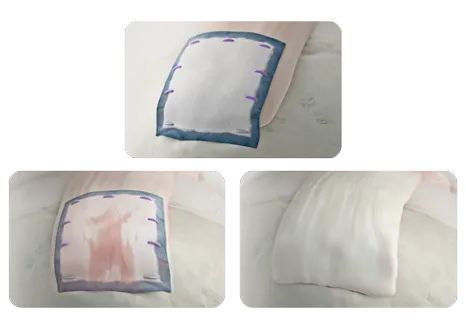 리제네텐이 힘줄로 바뀌는 과정 3단계 모식도. 패치를 덮은 직후, 패치 안으로 조직이 자라 든 중간 단계, 패치가 사라지고 힘줄이 두꺼워진 마지막 단계.