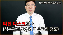 터진 디스크란? : 척추관의 모양과 디스크 증상의 관계