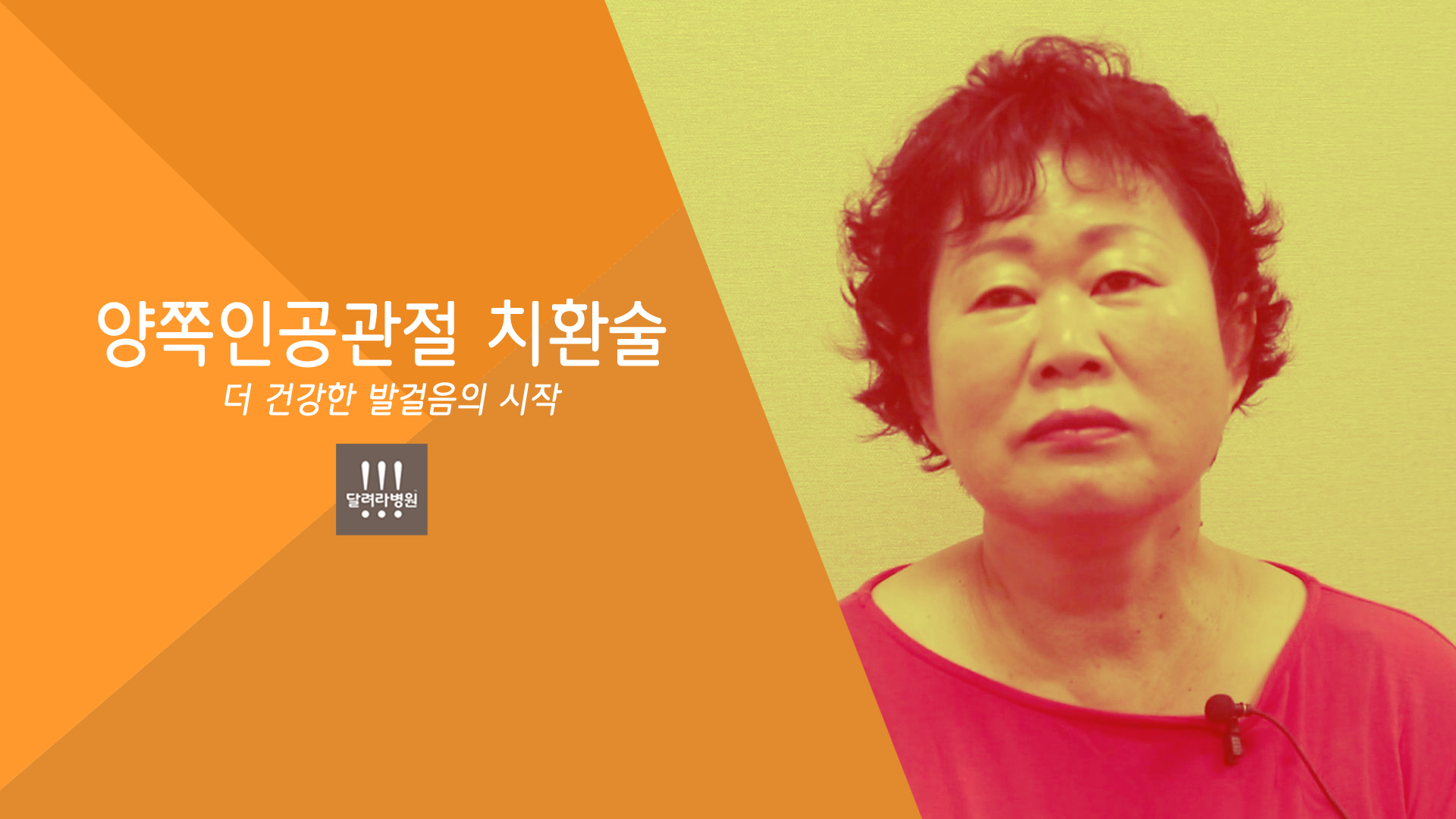 양쪽인공관절치환술