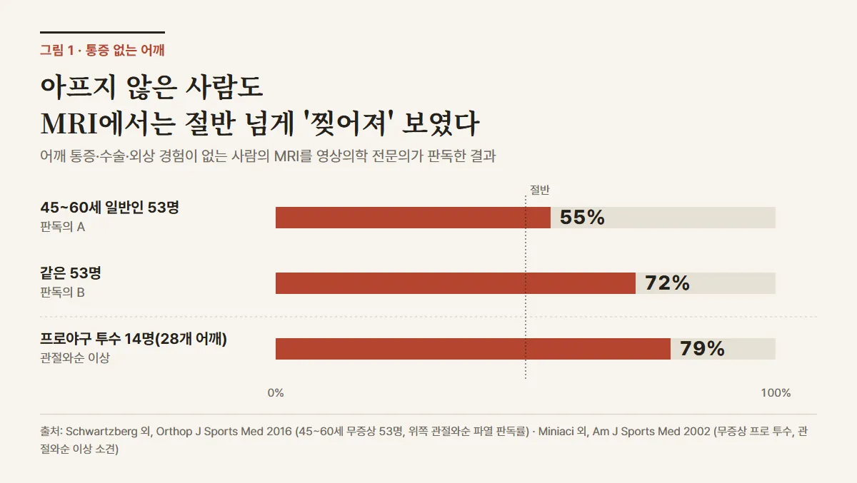 통증 없는 어깨의 MRI에서 관절와순 이상이 보인 비율. 45~60세 일반인 53명은 판독의 A 55%, 판독의 B 72%, 프로야구 투수 14명(28개 어깨)은 79%
